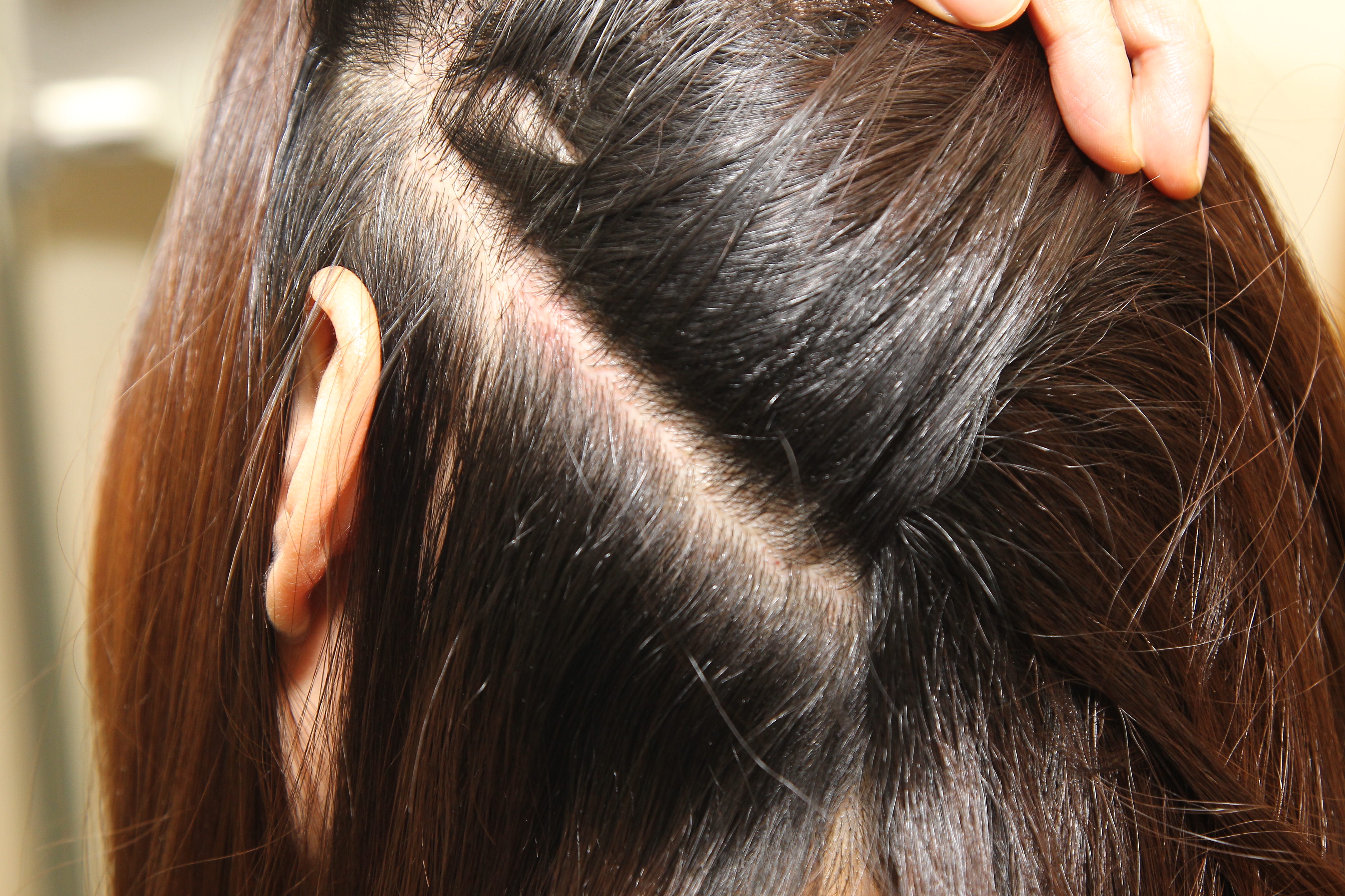 髮健康 確認頭皮是否健康1